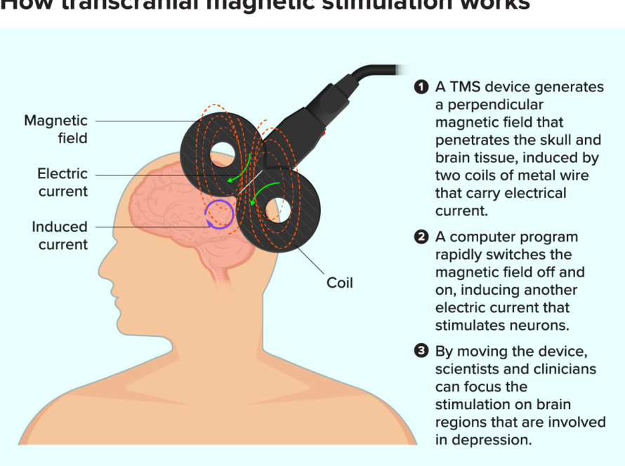How TMS Works
