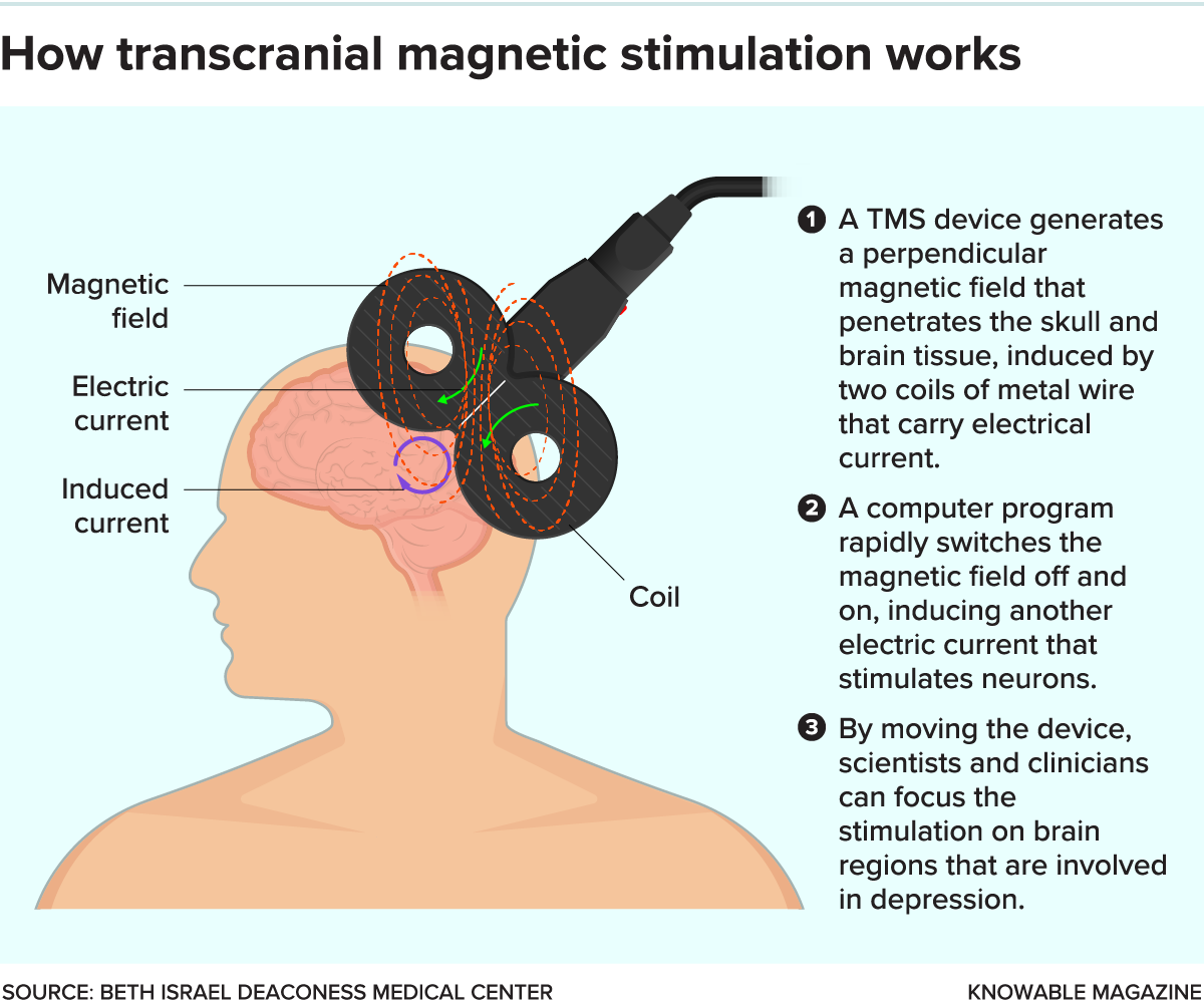 How TMS Works